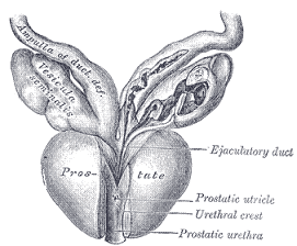 Enlarged Prostate